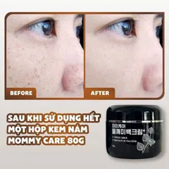 KEM NÁM MOMMY CARE PERILLA WHITENING CARE 80g