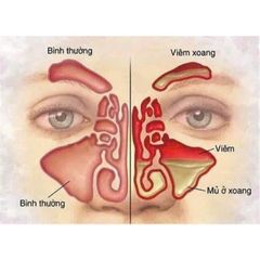 XỊT XOANG MŨI DAEWON HÀN QUỐC 30ml