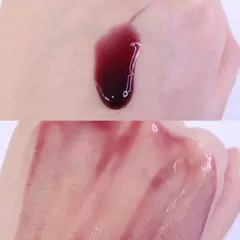 RED PEEL TINGLE SERUM – PEEL DA KHÔNG BONG TRÓC
