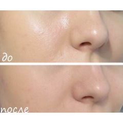Kem nền BB cream Baby Face nâng tone da