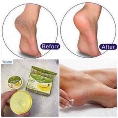 Kem trị nứt gót chân The banana Cream heels