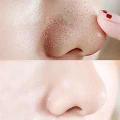 Combo 10 Miếng dán lột sạch sâu mụn đầu đen hiệu quả