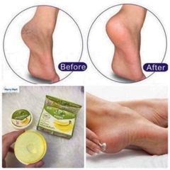 Kem giảm nứt gót chân The banana Cream heels