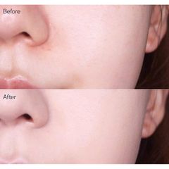 Serum trẻ hoá da , se khít lỗ chân lông Advanced 100ml