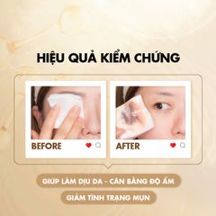 Nước Tẩy Trang Daliv Hàn Quốc 500ML - Dưỡng Ẩm Da, Làm Sạch Hiệu Quả, Phù Hợp Mọi Loại Da, Không Kích Ứng