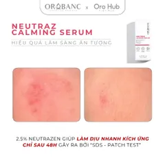 Tinh Chất Orobanc Làm Dịu Da, Giảm Đỏ, Phục Hồi - NeutraZ Calming Serum 30ml