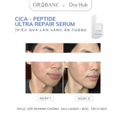 Tinh Chất Orobanc Phục Hồi, Tái Tạo Chuyên Sâu - Cica Peptide Ultra Repair Ampoule Serum 30ml