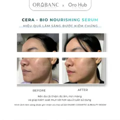 Tinh Chất Orobanc Giảm Mụn, Làm Dịu, Giảm Dầu, Phục Hồi Da Cera Bio Nourishing Serum 30ml
