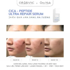 Tinh Chất Orobanc Phục Hồi, Tái Tạo Chuyên Sâu - Cica Peptide Ultra Repair Ampoule Serum 30ml
