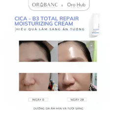 Kem Orobanc Dưỡng Ẩm, Làm Dịu Và Phục Hồi - Cica B3 Total Repair Moisturizing Cream 30g