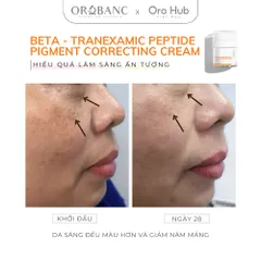 Kem Orobanc Dưỡng Sáng Da, Giảm Đốm Nâu Mờ Nám - Beta Tranexamic Peptide Pigment Correcting Cream 30g