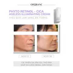 Combo Orobanc Trẻ Hoá Căng Mịn Mờ Nếp Nhăn - Ectoin B5 Serum 30ml - Phyto Retinol Cream 30gr