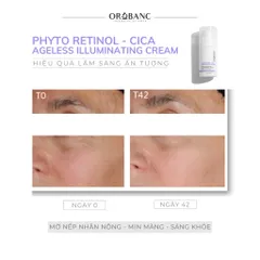 Combo Orobanc Trẻ Hoá Căng Mịn Mờ Nếp Nhăn - Ectoin B5 Serum 30ml - Phyto Retinol Cream 30gr