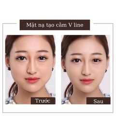 Combo 10 Mặt nạ định hình cằm V-line, tạo mặt Vline, Mặt Nạ Nâng Cơ, giảm mỡ nọng cằm (mặt nạ xài 1 lần) 759928