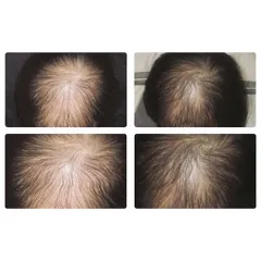 TINH DẦU BƯỞI GIẢM RỤNG KÍCH THÍCH MỌC TÓC MƯỢT TÓC 759952