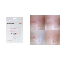 24 miếng] Miếng Dán Mụn Giúp Làm Dịu Và Hút Dịch Mủ Ciracle Red Spot Acne Pimple Patch 759976