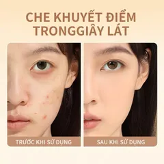 Bảng Kem Che Khuyết Điểm CONCEALER 5 Màu Độ Che Phủ Cao, Chống Nước Lâu Trôi 760687