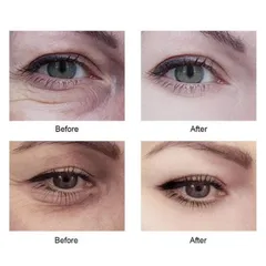 [Mỹ] Serum mắt Dark Circle Serum Fragrance Free 1.75 fl oz 52ml ngăn ngừa quầng thâm mắt
