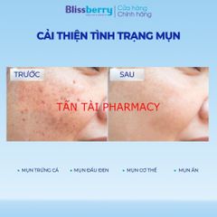 ✅[CHÍNH HÃNG, CHO KIỂM HÀNG]  Gel giảm mụn mờ thâm Blissberry Pureskin Acne Fixer K21 15ml