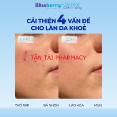 ✅[CHÍNH HÃNG, CHO KIỂM HÀNG] Serum cấp ẩm kiềm dầu Blissberry Pureskin Daily Gentle Calming 30ml
