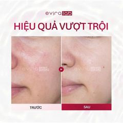Kem Dưỡng Trắng Da Mờ Nám EVIRALAB MELA LIGHT CREAM 50ml [hàng nhập khẩu]