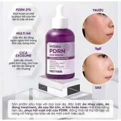 SERUM PHỤC HỒI CHUYÊN SÂU PRETTYSKIN HYDRA PDRN MAX CLINIC