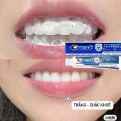 [ HỎA TỐC]  Kem Đánh Răng Crest Pro-Health Advanced Whitening & Intensive Clean 167g 🦷