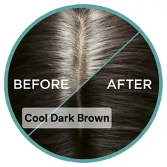 Xịt Che Phủ Chân Tóc L'Oréal Paris Magic Retouch Nhanh Gọn