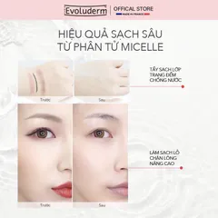 COMBO Xịt khoáng Evoluderm 400ml và Nước tẩy trang 250ml