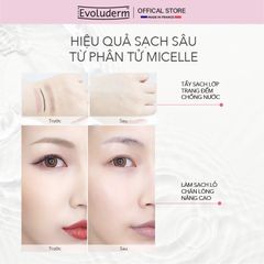COMBO Xịt khoáng Evoluderm 150ml và Nước tẩy trang sạch sâu, dưỡng ẩm Evoluderm 250ml