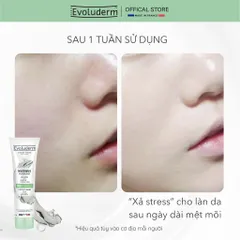 [HSD:10.26] Mặt nạ đất sét ngừa mụn sáng da giảm bã nhờn hiệu quả Evoluderm clay mask Purifying 150ml