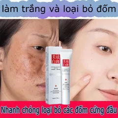 Kem trắng da và xóa tàn nhang Kem nám tàn nhang 20g kem dưỡng trắng da mặt Hiệu quả làm mờ thâm nám tàn nhang