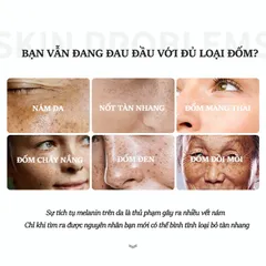 Kem trắng da và xóa tàn nhang Kem nám tàn nhang 20g kem dưỡng trắng da mặt Hiệu quả làm mờ thâm nám tàn nhang