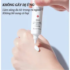 Kem trắng da và xóa tàn nhang Kem nám tàn nhang 20g kem dưỡng trắng da mặt Hiệu quả làm mờ thâm nám tàn nhang