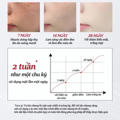 Kem trắng da và xóa tàn nhang Kem nám tàn nhang 20g kem dưỡng trắng da mặt Hiệu quả làm mờ thâm nám tàn nhang