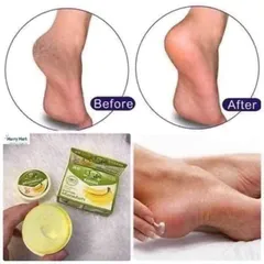 Kem bôi nứt gót chân hương chuối Thái Lan