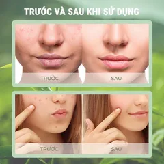 Mặt nạ trà xanh dạng lăn GREEN MASK STICK, Thanh lăn mặt nạ trà xanh Green mask stick - Cam Kết Chính hãng