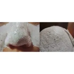 Gel lột mụn PEELING PACK hút sạch nhân mụn, làm sạch mụn cám