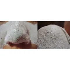 Combo 2 hộp Gel lột mụn PEELING PACK
