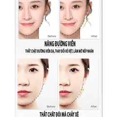 Mặt nạ thon gọn mặt nâng cơ vline