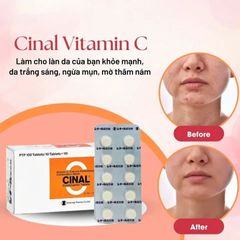 Viên Uống Trắng Da Cinal C 100 Viên Nhật Nội Địa - Hỗ Trợ Sáng Da, Giảm Mụn, Bổ Sung Vitamin C Chính Hãng