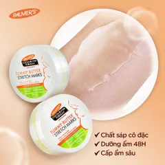 Kem dưỡng hỗ trợ ngừa và giảm rạn da
