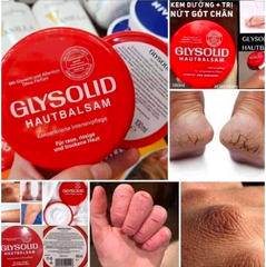 Kem nẻ Glysolid Hautbalsam 100ml – Giải pháp hoàn hảo cho làn da khô nứt nẻ. Đức