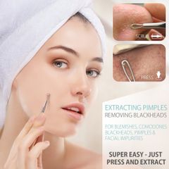 Cây nặn mụn inox MiraCulous Pimple Remover Tool Cao cấp Hàn Quốc - Hàng chính hãng 784934