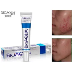 Kem hỗ trợ mụn thâm BioAqua 30ml 787911