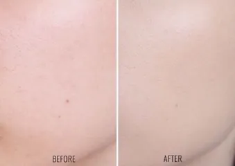 Kem nền BB cream Baby Face nâng tone da 788075