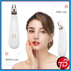 Máy hút mụn mini cao cấp Black Head Detector 788112