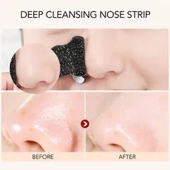 HOT Combo 10 Miếng dán mũi lột mụn đầu đen rửa sạch sâu lỗ chân lông 788134