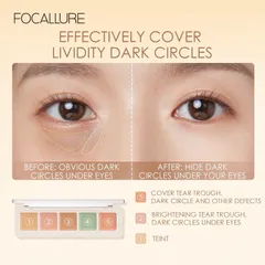 Bảng Che Khuyết Điểm tạo khối Allround Concealer Palette 788221