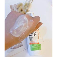 [Chai 250ml] Kem dưỡng Rạn Da, Dưỡng Da Cho Mẹ Bầu Palmer's Cocoa Butter Formula Massage Lotion For Stretch Marks